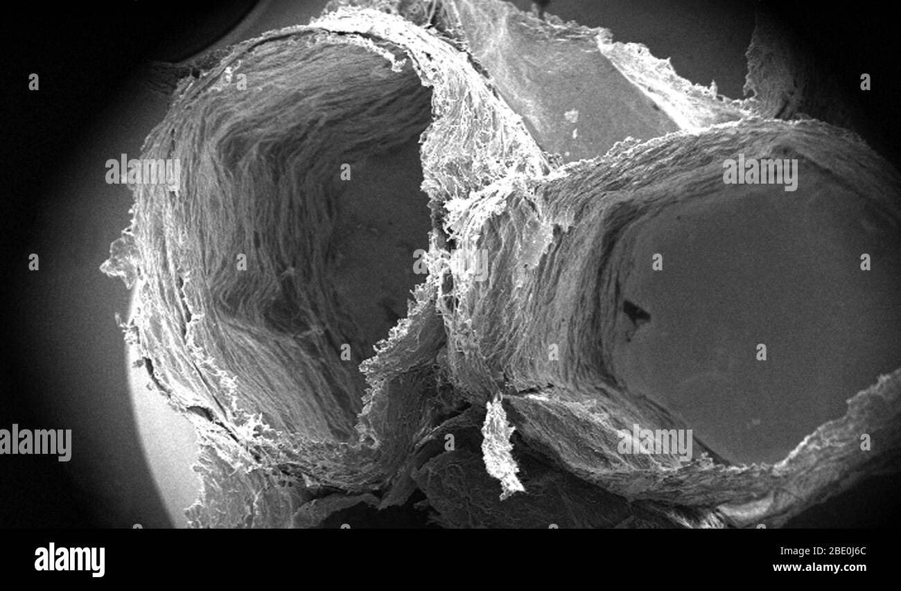 At a very low magnification of only 12x, this scanning electron micrograph (SEM) depicts some of the ultrastructural details made visible of the surface of an unidentified wasps' nest. Note what appears to be a lamellated, or layered pattern, which was used by the nest builders in the construction of the hexagonally-shaped cells. Wasp nests are primarily composed of a mixture of masticated wood chips, and the salivary secretions of the female wasps, who chew and apply the mixture in a nest-building fashion unique to the specie of wasp. The nest is built around a configuration of hexagonal-shap Stock Photo