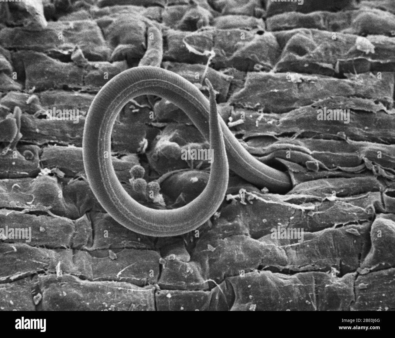 Scanning Electron Micrograph of the whiplike larva of the root-knot nematode Meloidogyne incognita penetrating a tomato root. Once inside, the larva establishes a feeding site and causes nutrient-robbing galls to form on cells. As the larva consumes nutrients, the plant's growth is stunted. Magnification 900x at 8'x10'. Stock Photo