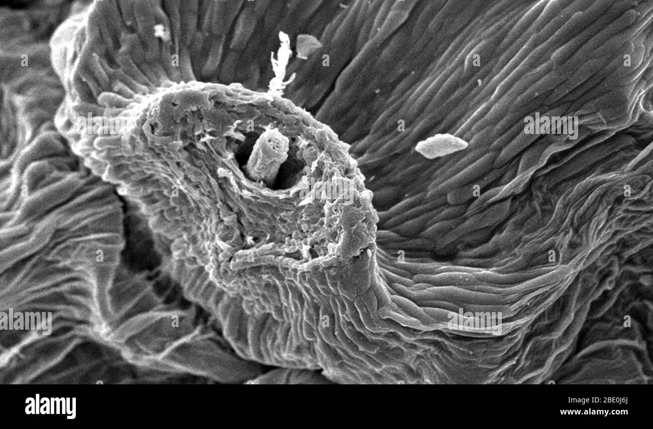 Under a moderate magnification of 225x, this scanning electron micrograph (SEM) depicted details of the morphologic surface characteristics of a 'dandelion clock', from a Common Dandelion, Taraxacum officinale plant. The 'clock' is the filamentous 'puffball' of seeds arranged so as to be easily dispersed by the wind, or the breadth of a curious child. In this field of view the remnants of a seed attachment is visible as a small nub protruding from a small papule. It is from these nub-like points that the 'parachute'-equipped seeds detach, and are blown away, sometime over a distance of miles. Stock Photo