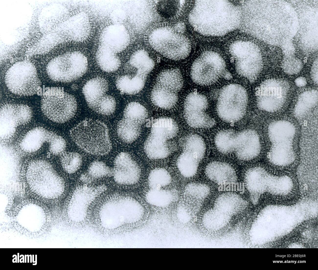 Transmission electron micrograph (TEM) of influenza A virus. Stock Photo