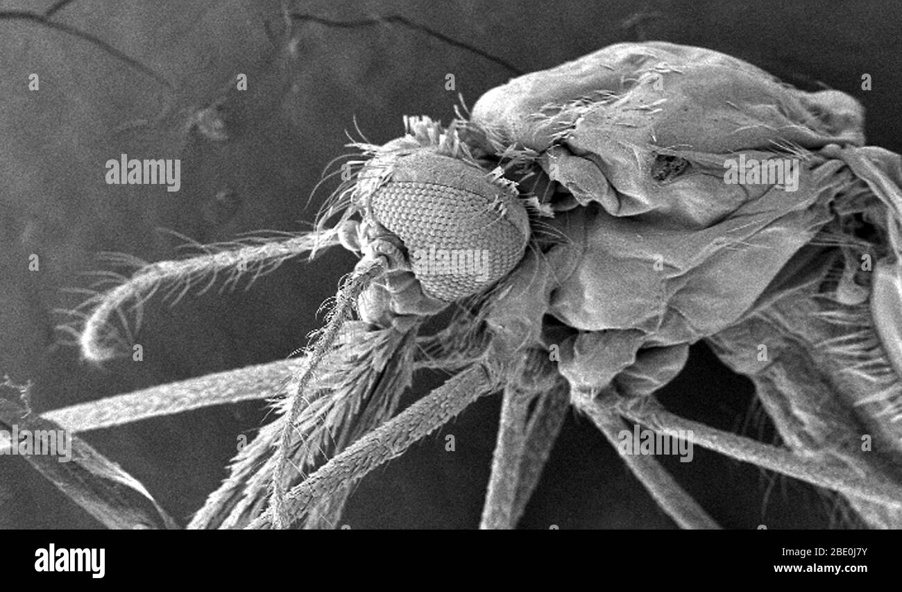 SEM showing the ultrastructural morphologic surface features of the head, and thoracic regions of an Anopheles gambiae mosquito. Human malaria is transmitted only by females of the genus Anopheles. Of the approximately 430 Anopheles species, only 30-40 transmit malaria in nature. An organism that transmits a disease to another organism is known as a vector. Note the compound eye, composed of numerous ommatidia, which are the small subunits that act in concert with one another to provide a comprehensive mosaic image to the organism of its surroundings. Like all mosquitoes, adult anophelines hav Stock Photo
