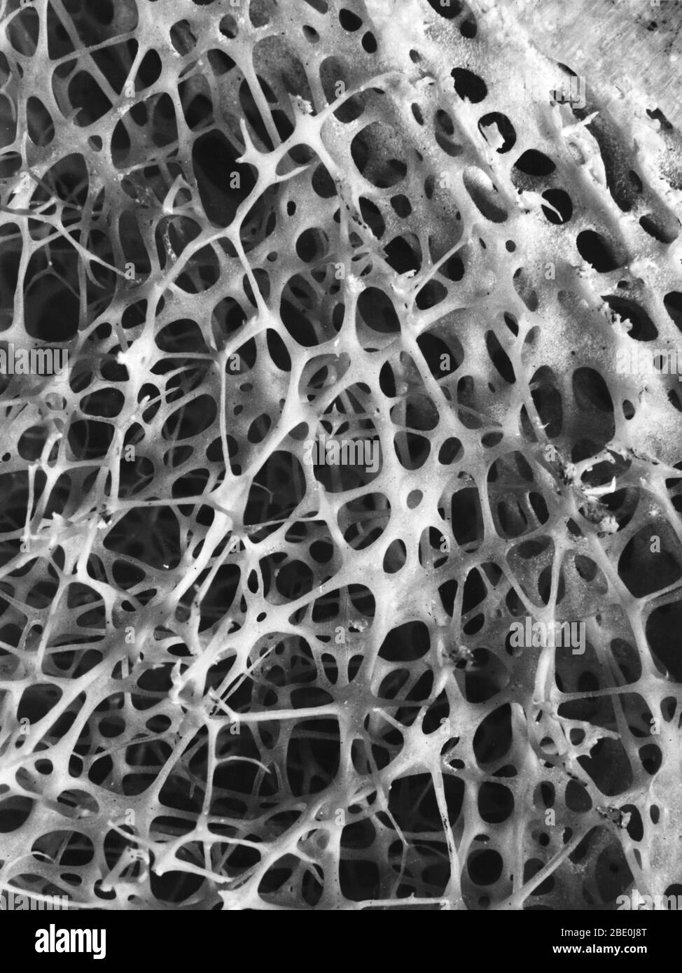 Scanning electron micrograph (SEM) of cancellous (spongy) bone of the human shin. Bone tissue is either compact or cancellous. Compact bone usually makes up the exterior of the bone, while cancellous bone is found in the interior. Cancellous bone is characterized by a honeycomb arrangement of trabeculae. These structures help to provide support and strength. The spaces within this tissue normally contain bone marrow, a blood forming substance. Stock Photo