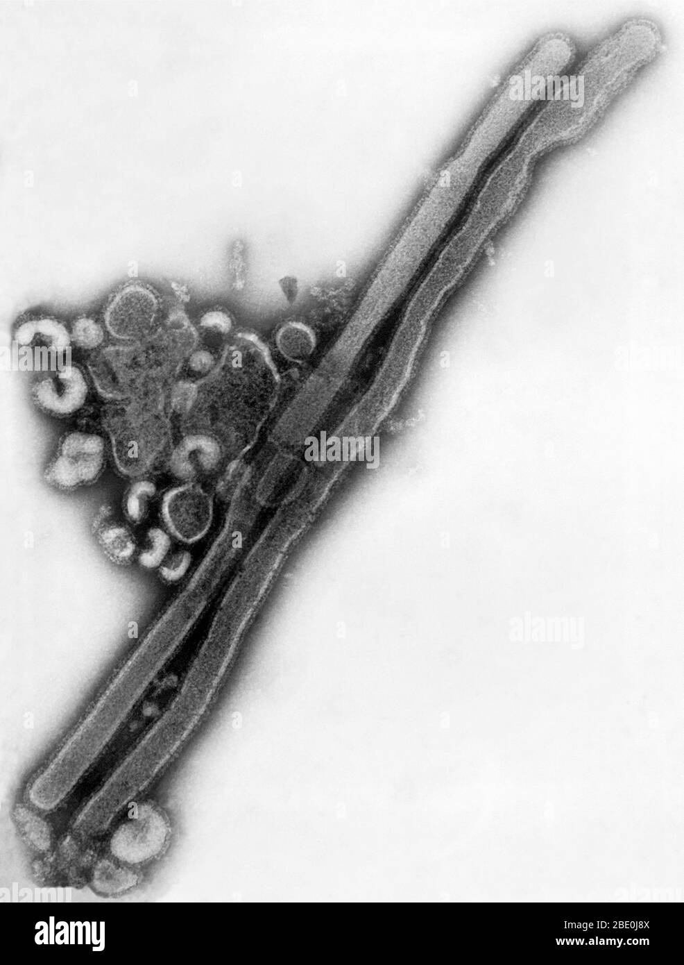 Negatively-stained transmission electron microscopic (TEM) image revealed the presence of a number of influenza virus virions. This virus is a Orthomyxoviridae virus family member. The Orthomyxoviruses are a family of RNA viruses that includes seven genera: Influenza virus A, Influenza virus B, Influenza virus C, Influenza virus D, Isavirus, Thogotovirus and Quaranjavirus. The first three genera contain viruses that cause influenza in vertebrates, including birds (see also avian influenza), humans, and other mammals. Influenza A and B viruses cause seasonal epidemics of disease almost every wi Stock Photo