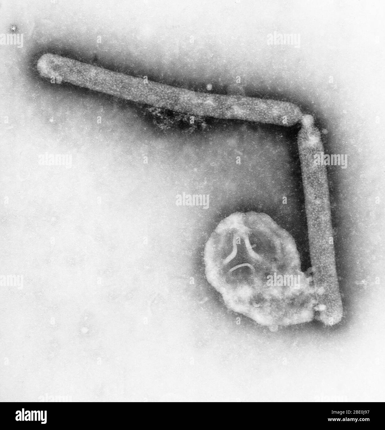 Transmission Electron Micrograph (TEM), revealing the ultrastructural details of two avian influenza A (H5N1) virions, a type of bird flu virus, which is a subtype of avian influenza A. At this magnification, one may note the stippled appearance of the roughened surface of the proteinaceous coat encasing each virion. Although this virus does not typically infect humans, in 1997, the first instance of direct bird-to-human spread of influenza A (H5N1) virus was documented during an outbreak of avian influenza among poultry in Hong Kong. The virus caused severe respiratory illness in 18 people, o Stock Photo