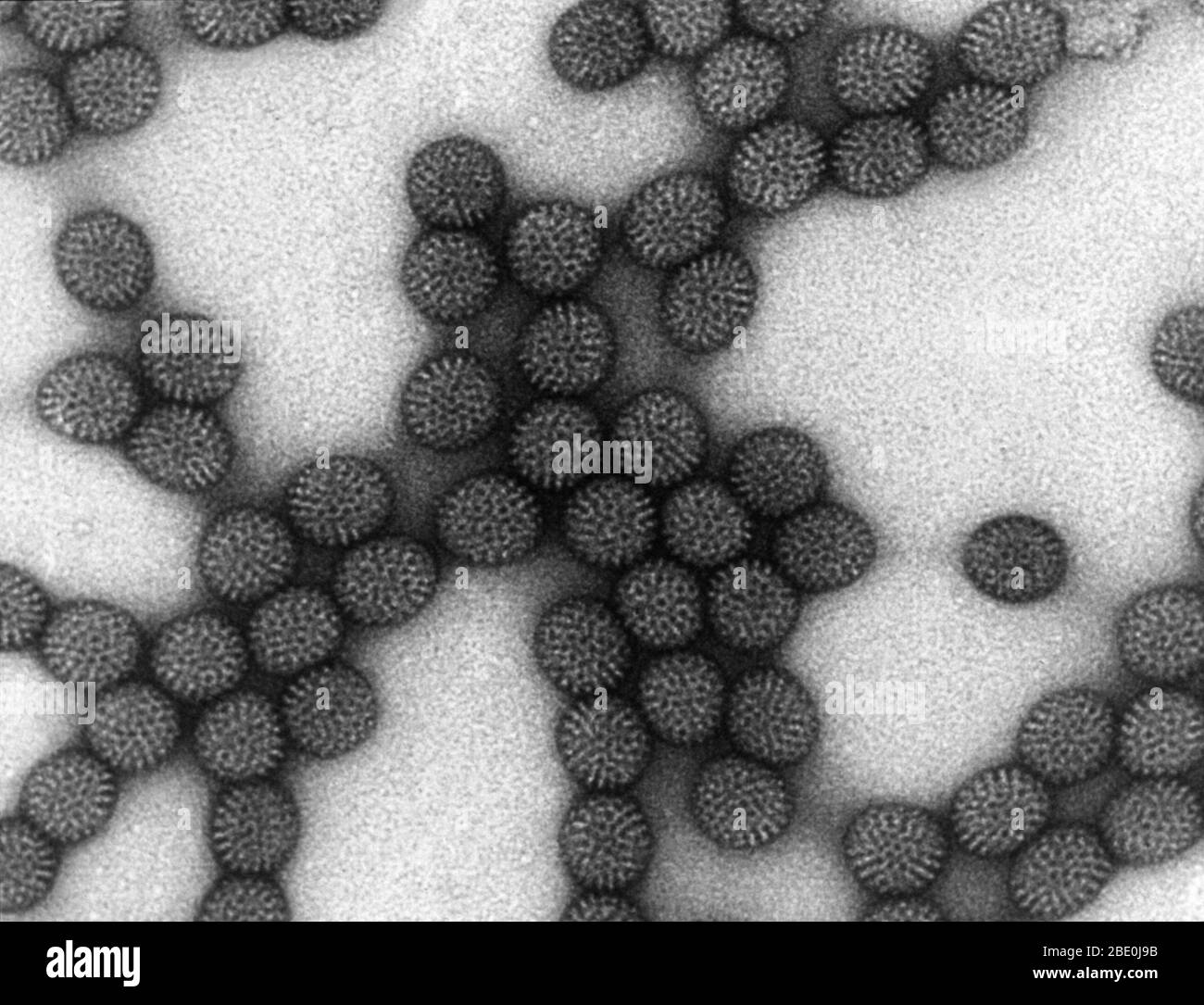 Transmission Electron Micrograph (TEM) of Rotavirus. Group A rotavirus is endemic worldwide. It is the leading cause of severe diarrhea among infants and children, and accounts for about half of the cases requiring hospitalization. Rotavirus is usually an easily managed disease of childhood, but in 2013, rotavirus caused 37% of deaths of children from diarrhea and 215,000 deaths worldwide, and almost 2 million more become severely ill. Most of these deaths occurred in developing countries. In the United States, before initiation of the rotavirus vaccination program, rotavirus caused about 2.7 Stock Photo