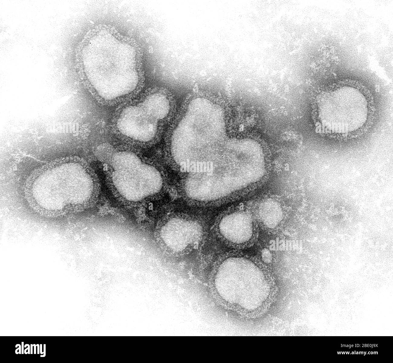 Negative-stained Transmission Electron Micrograph (TEM) showing you a number of Influenza A virions. Influenza A virus causes influenza in birds and some mammals, and is the only species of influenza virus A. Influenza virus A is a genus of the Orthomyxoviridae family of viruses. Strains of all subtypes of influenza A virus have been isolated from wild birds, although disease is uncommon. Some isolates of influenza A virus cause severe disease both in domestic poultry and, rarely, in humans. Occasionally, viruses are transmitted from wild aquatic birds to domestic poultry, and this may cause a Stock Photo