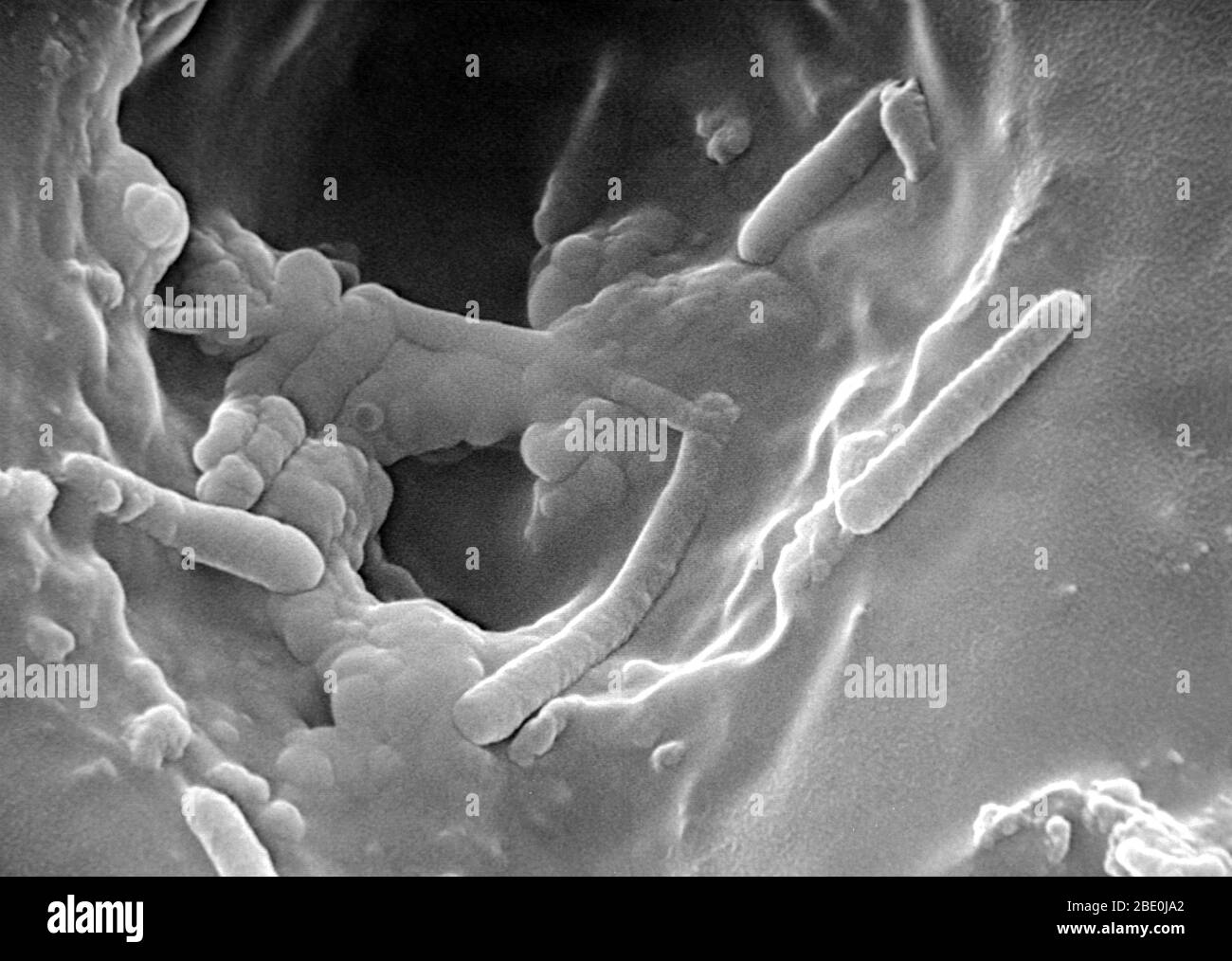 Scanning Elctron Micrograph (SEM) of Pseudomonas aeruginosa, a versatile gram-negative bacterium that grows in soil, marshes, and coastal marine habitats, as well as on plant and animal tissues. Pseudomonas aeruginosa is rod-shaped bacterium that can cause disease in plants and animals, including humans. A species of considerable medical importance, P. aeruginosa is a multidrug resistant pathogen recognised for its ubiquity, its intrinsically advanced antibiotic resistance mechanisms, and its association with serious illnesses, hospital-acquired infections such as ventilator-associated pneumon Stock Photo