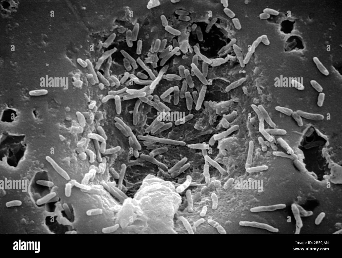 Scanning Electron Micrograph (SEM) of Mycobacterium chelonae, a type of bacteria related to that which causes tuberculosis, and which is commonly found in soil and sometimes in sputum. Mycobacterium chelonae is a species of the phylum actinobacteria (gram-positive bacteria with high guanine and cytosine content, one of the dominant phyla of all bacteria), belonging to the genus mycobacterium. M. chelonae is a rapidly growing mycobacterium, that is found all throughout the environment including sewage and tap water. M. chelonae can cause postoperative wound infections in soft tissue and bone in Stock Photo
