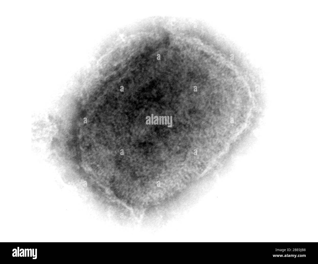 Negative-stained Transmission Electron Micrograph (TEM) demonstrating the brick-shaped monkeypox virus from a cell culture. The surface mulberry virion (right) are covered with short, whorled filaments, while capsular virions (left) penetrated by stain present as a sharply defined, dense core surrounded by several laminated zones of differing densities. Monkeypox virus (MPV) is a double-stranded DNA, zoonotic virus and a species of the genus Orthopoxvirus in the family Poxviridae. It is one of the human orthopoxviruses that includes variola (VARV), cowpox (CPX), and vaccinia (VACV) viruses. Bu Stock Photo