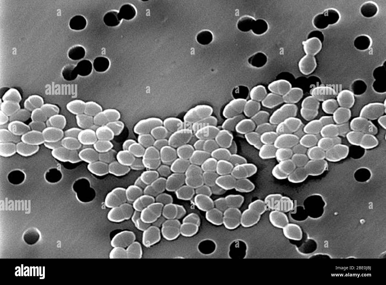 Scanning Electron Micrograph (SEM) of Vancomycin Resistant Enterococci (VRE). Strains of the bacteria, Enterococci, that are resistant to the antibiotic vancomycin, known as Vancomycin Resistant Enterococci, were found in France in 1986. Illness due to VRE infections in healthy people is rare. Common infections caused by enterococci are urinary tract inections and wound infections. Stock Photo