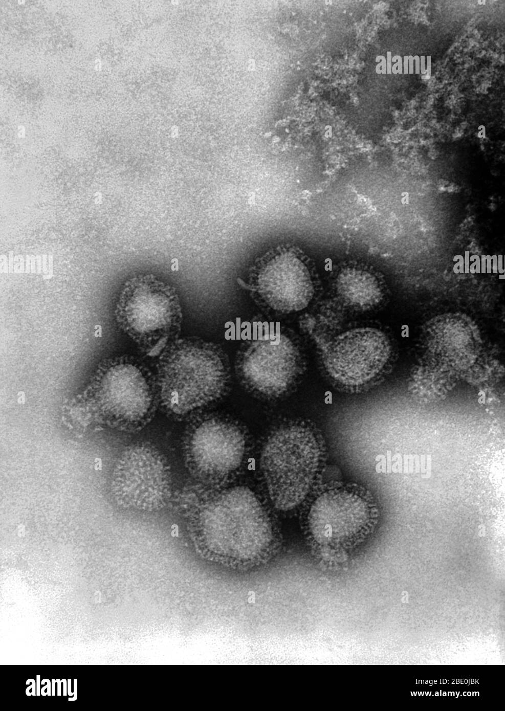 Negative-stained Transmission Electron Micrograph (TEM) revealing the presence of a number of Hong Kong flu virus virions, the H3N2 subtype of the influenza A virus. This virus is a Orthomyxoviridae virus family member, and was responsible for the flu pandemic of 1968-1969, which infected an estimated 50,000,000 people in the United States, killing 33,000. Note the proteinaceous coat, or capsid, surrounding each virion, and the hemagglutinin-neuraminidase spikes, which differ in terms of their molecular make-up from strain to strain. There are many different subtypes of type A influenza viruse Stock Photo