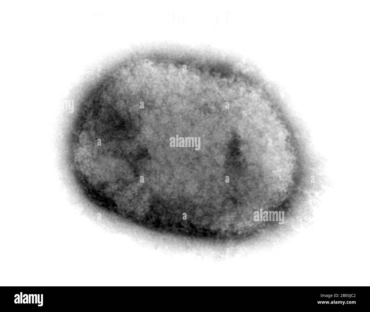 Negative-stained Transmission Electron Micrograph (TEM) demonstrating the brick-shaped monkeypox virus from a cell culture. The surface mulberry virion is covered with short, whorled filaments. Monkeypox virus (MPV) is a double-stranded DNA, zoonotic virus and a species of the genus Orthopoxvirus in the family Poxviridae. It is one of the human orthopoxviruses that includes variola (VARV), cowpox (CPX), and vaccinia (VACV) viruses. But it is not a direct ancestor to, nor a direct descendent of, the variola virus which causes smallpox. The monkeypox virus causes a disease that is similar to sma Stock Photo