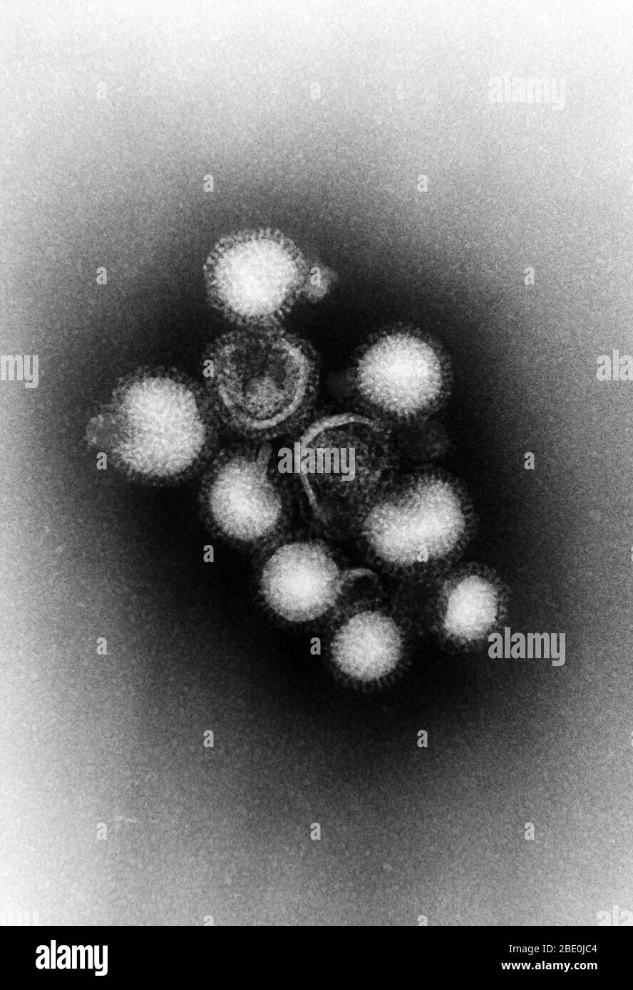 Negative-stained Transmission Electron Micrograph (TEM) showing you a number of Influenza A virions. Influenza A virus causes influenza in birds and some mammals, and is the only species of influenza virus A. Influenza virus A is a genus of the Orthomyxoviridae family of viruses. Strains of all subtypes of influenza A virus have been isolated from wild birds, although disease is uncommon. Some isolates of influenza A virus cause severe disease both in domestic poultry and, rarely, in humans. Occasionally, viruses are transmitted from wild aquatic birds to domestic poultry, and this may cause a Stock Photo