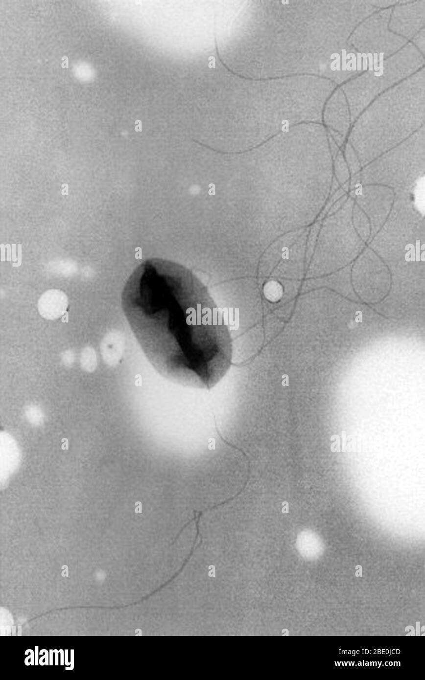 Transmission Electron Micrograph (TEM) of Escherichia coli (E. coli) O157:H7 showing flagella (pseudoreplica technique). The bacterium is a known cause of foodborne illness. The strain of E. coli, O157:H7, was first recognized in 1982 during an outbreak of severe diarrhea that was caused by contaminated hamburgers. Infection can be prevented by making sure that meat is cooked thoroughly. Escherichia coli is a gram-negative, facultatively anaerobic, rod-shaped, coliform bacterium of the genus Escherichia that is commonly found in the lower intestine of warm-blooded organisms (endotherms). Magni Stock Photo
