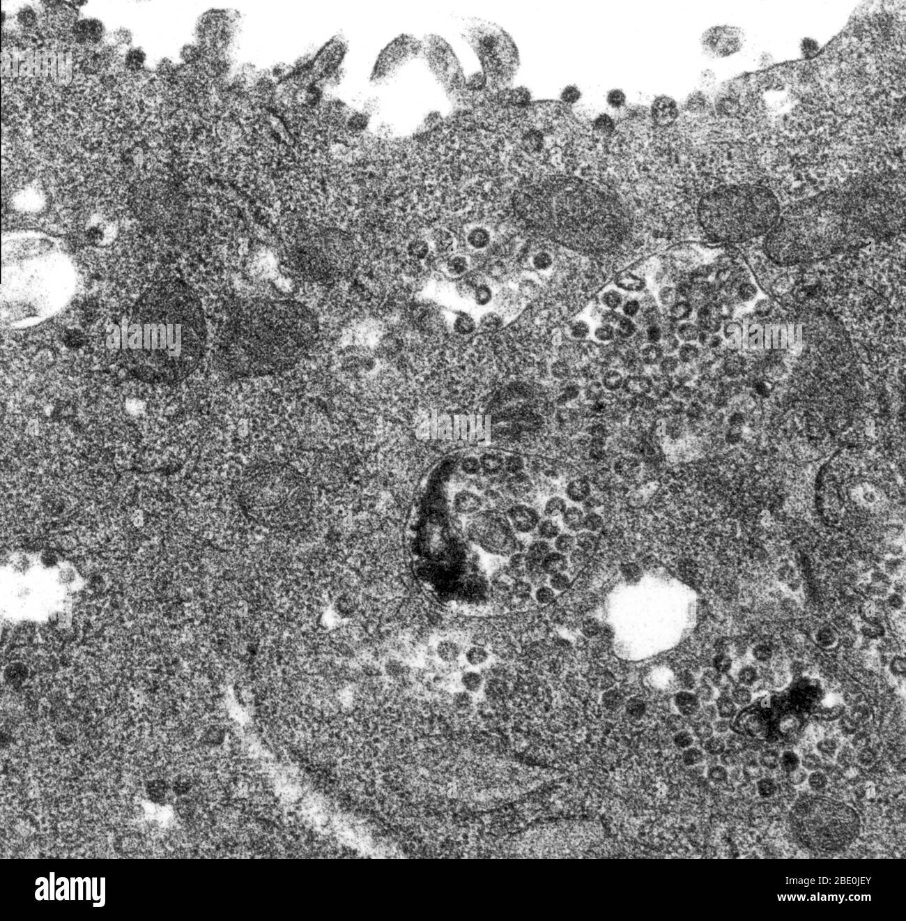 Transmission Electron Micrograph (TEM) of a thin section TEM of an infected Vero E6 cell, revealing the presence of coronavirus particles. Note that the viral particles are contained within the cell’s cytoplasmic membrane-bound vacuoles, and cisternae of the rough endoplasmic reticulum. Vero cells are a lineage of cells used in cell cultures. Coronaviruses are species of virus belonging to the subfamily Coronavirinae in the family Coronaviridae, in the order Nidovirales. Coronaviruses are enveloped viruses with a positive-sense single-stranded RNA genome and with a nucleocapsid of helical symm Stock Photo