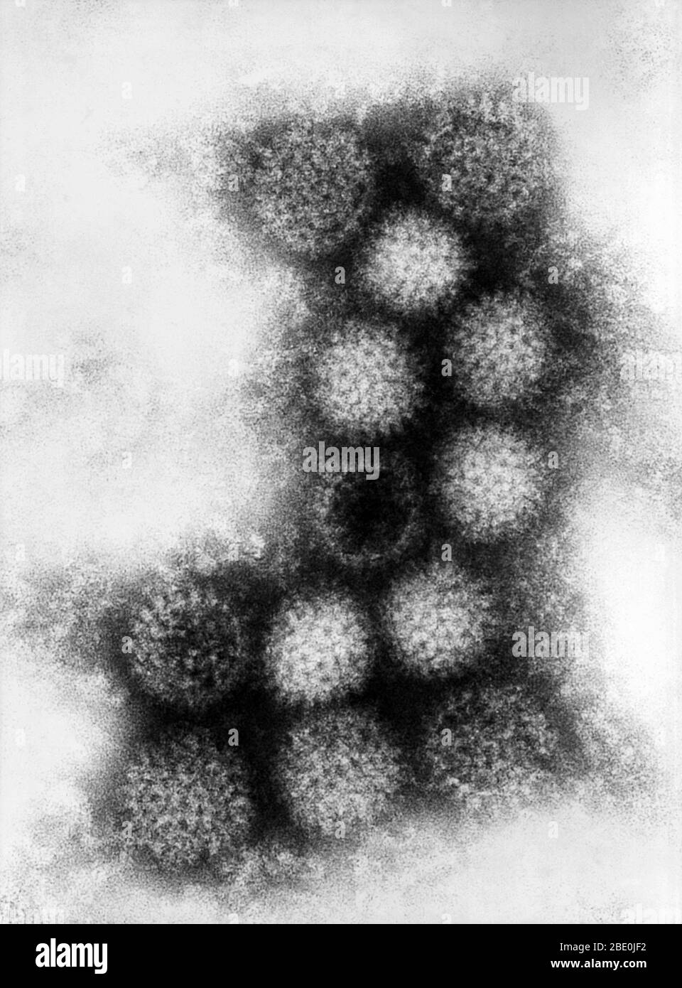 Transmission Electron Micrograph (TEM) reveals some of the morphologic details displayed by the Irituia strain of the Changuinola virus, a member of the genus, Orbiviruses, which is one of nine genera of the virus family known as the Reoviridae. The Changuinola virus inhabits Panama and northern South America. The Irituia virion, consists of a capsid, which is not enveloped, and which is spherical in shape, 60-80nm in diameter. The core consists of ten segments of double-stranded RNA. The Irituia virus has been classified as a Biosafety Level-2 pathogen. As an arbovirus, Changuinola virus is s Stock Photo