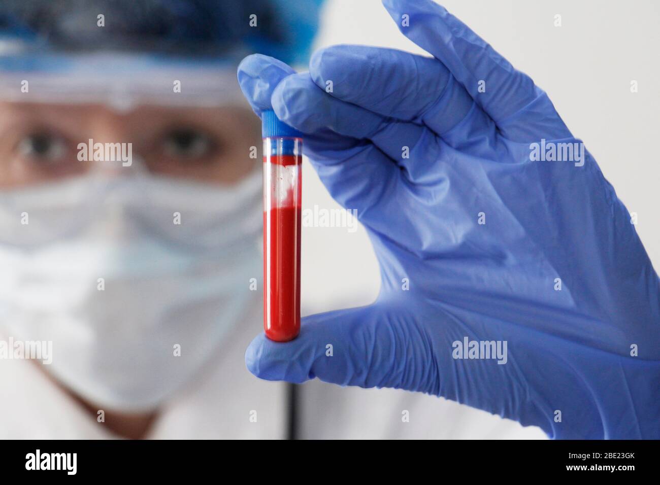 A nurse holds a test tube with blood in her hand. Laboratory test for the determination of coronavirus. The doctor performs an infection test. Concept Stock Photo