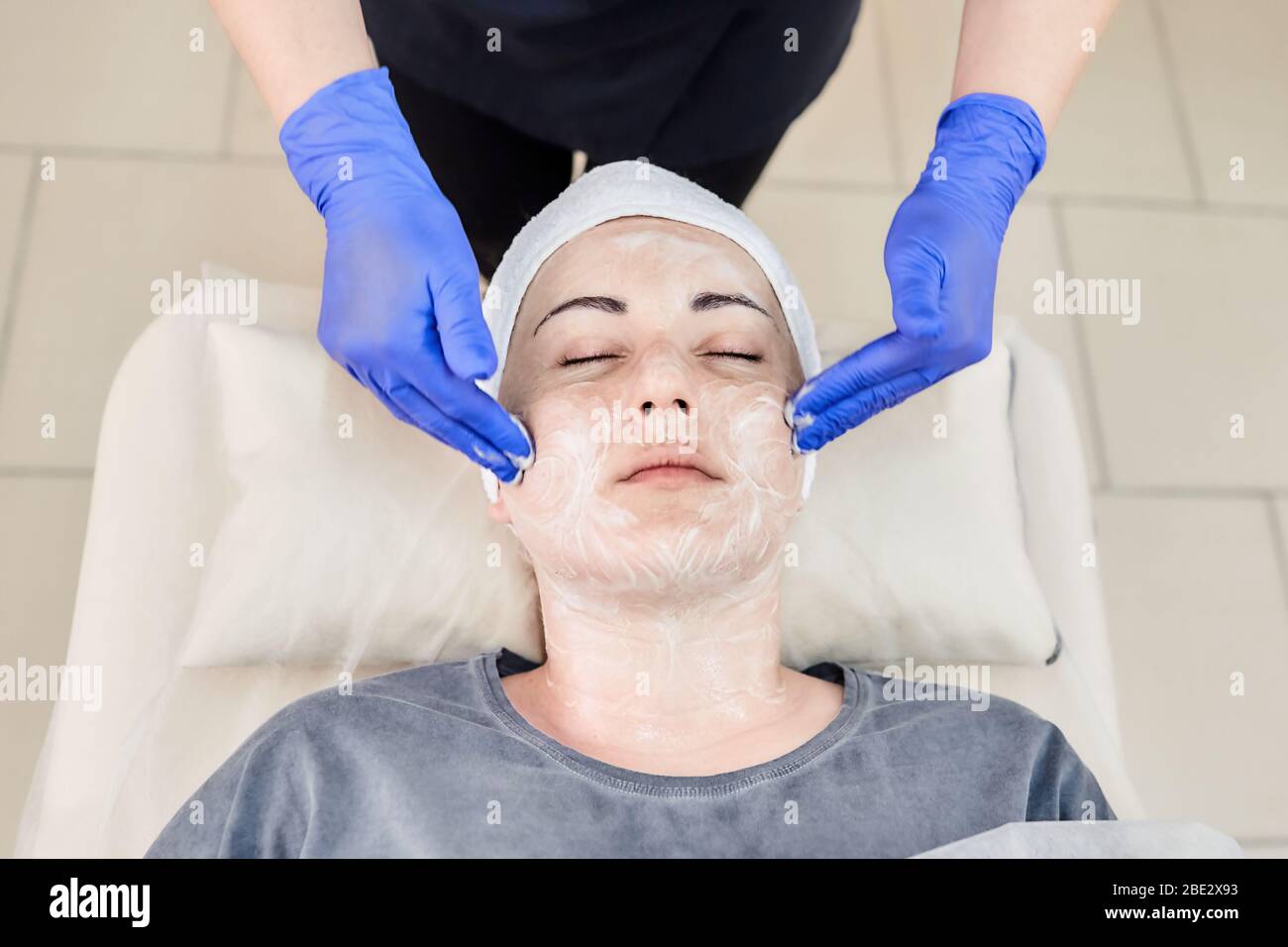 Skin pilling hires stock photography and images Alamy