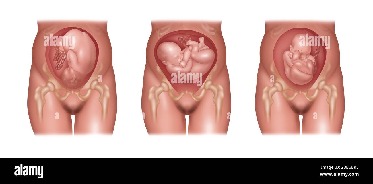 Baby Uterus Illustration High Resolution Stock Photography And Images Alamy