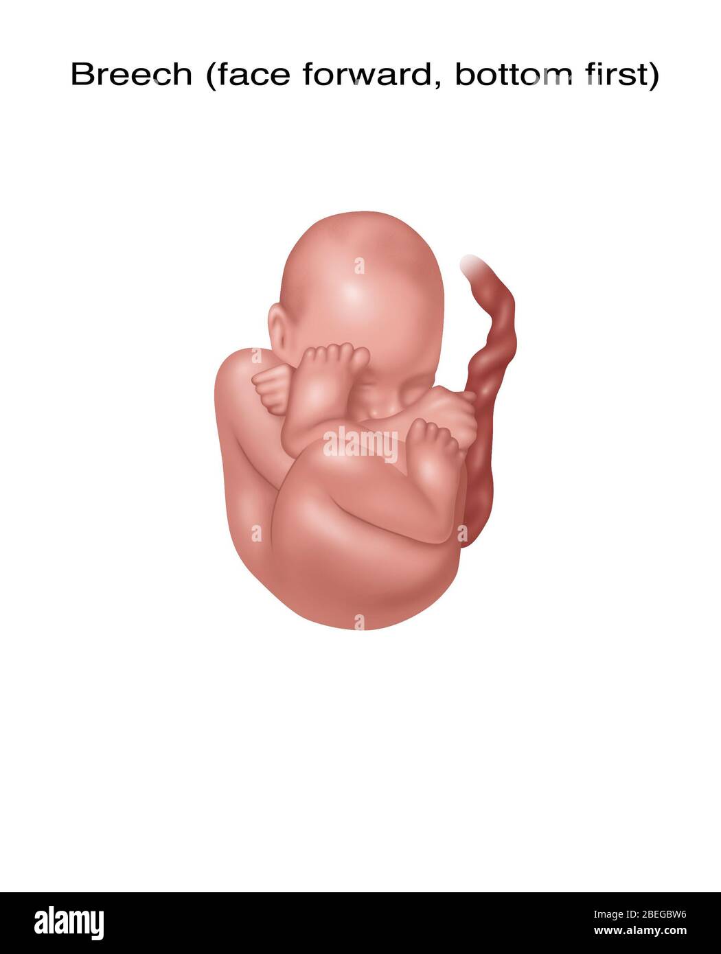 Fetus in Breech Position, Illustration Stock Photo