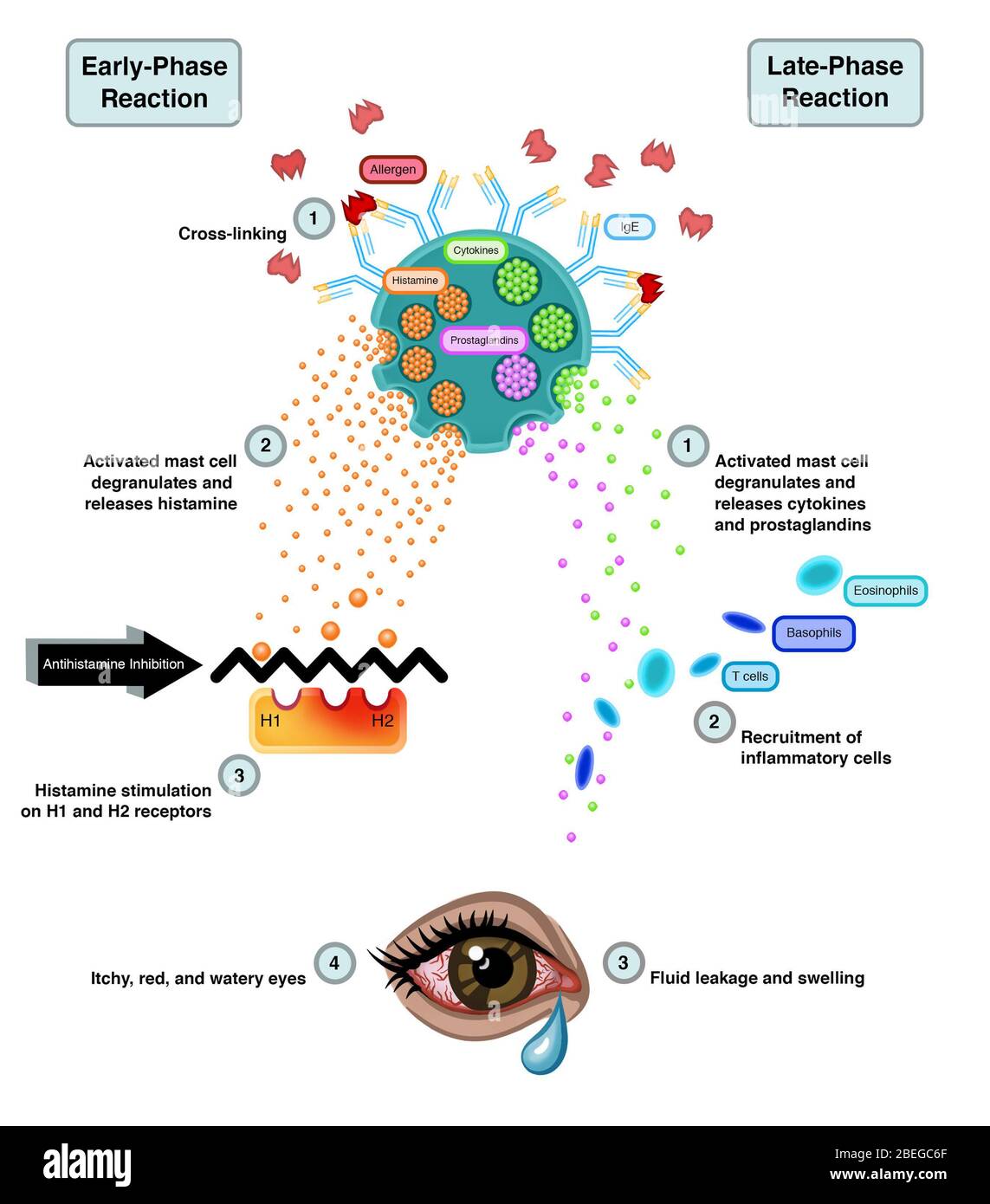 immune response flow chart