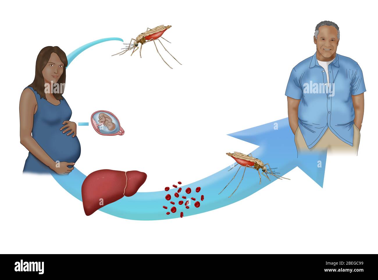 A simplified version of the malaria cycle. Malaria is a vector borne disease transmitted by the Anopheles mosquito bite. Malaria can also be transmitted to an infant during birth if the mother is infected. Mosquitos acquire the malaria parasite by biting an infected person or animal. Stock Photo