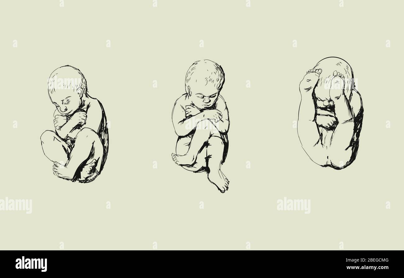 Illustration showing various breech birth positions. Stock Photo