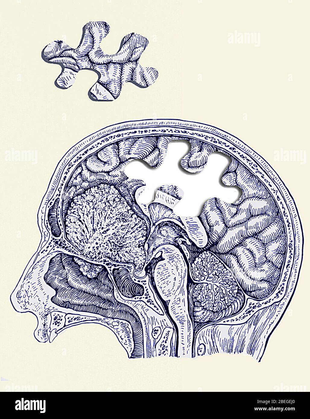 Missing Brain Piece Stock Photo