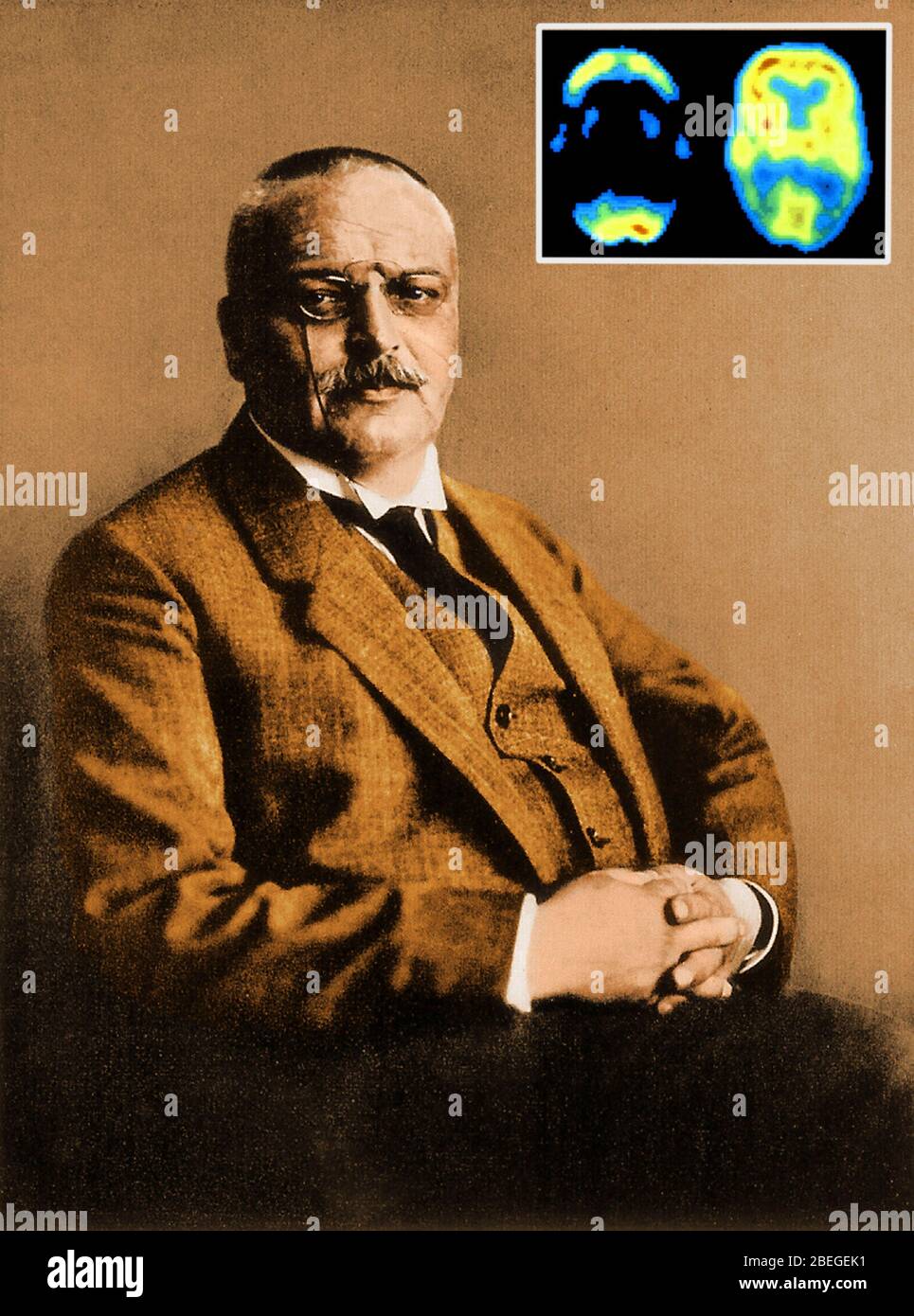 Alois Alzheimer with PET Scans Stock Photo