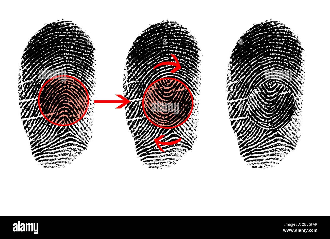 Fingerprint Mutilation Stock Photo