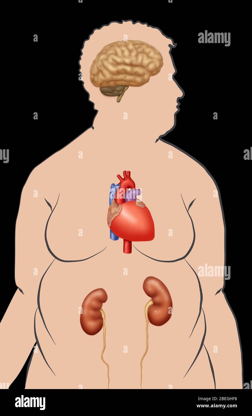 Risk Factors Of Obesity