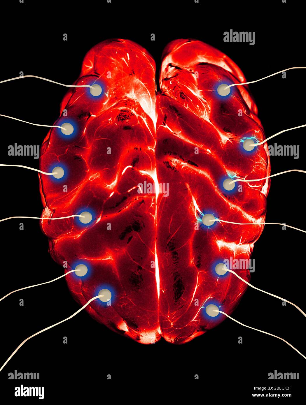 Brain EEG Stock Photo