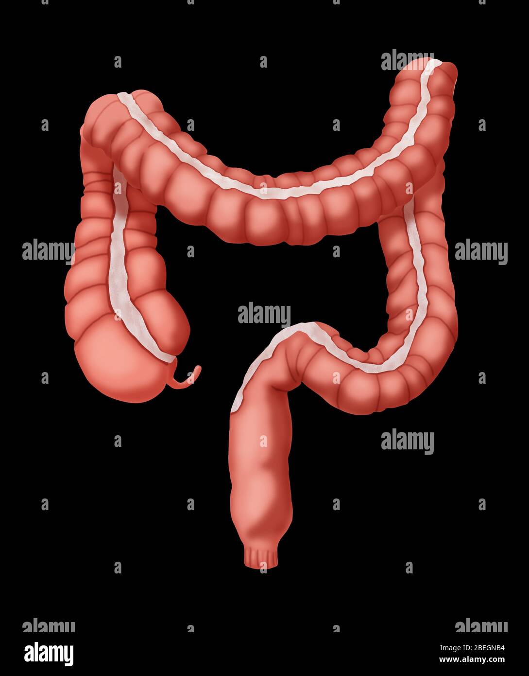 Large Intestine Fill In Healthy Large Intestines High Resolution Stock Photography and Images ...