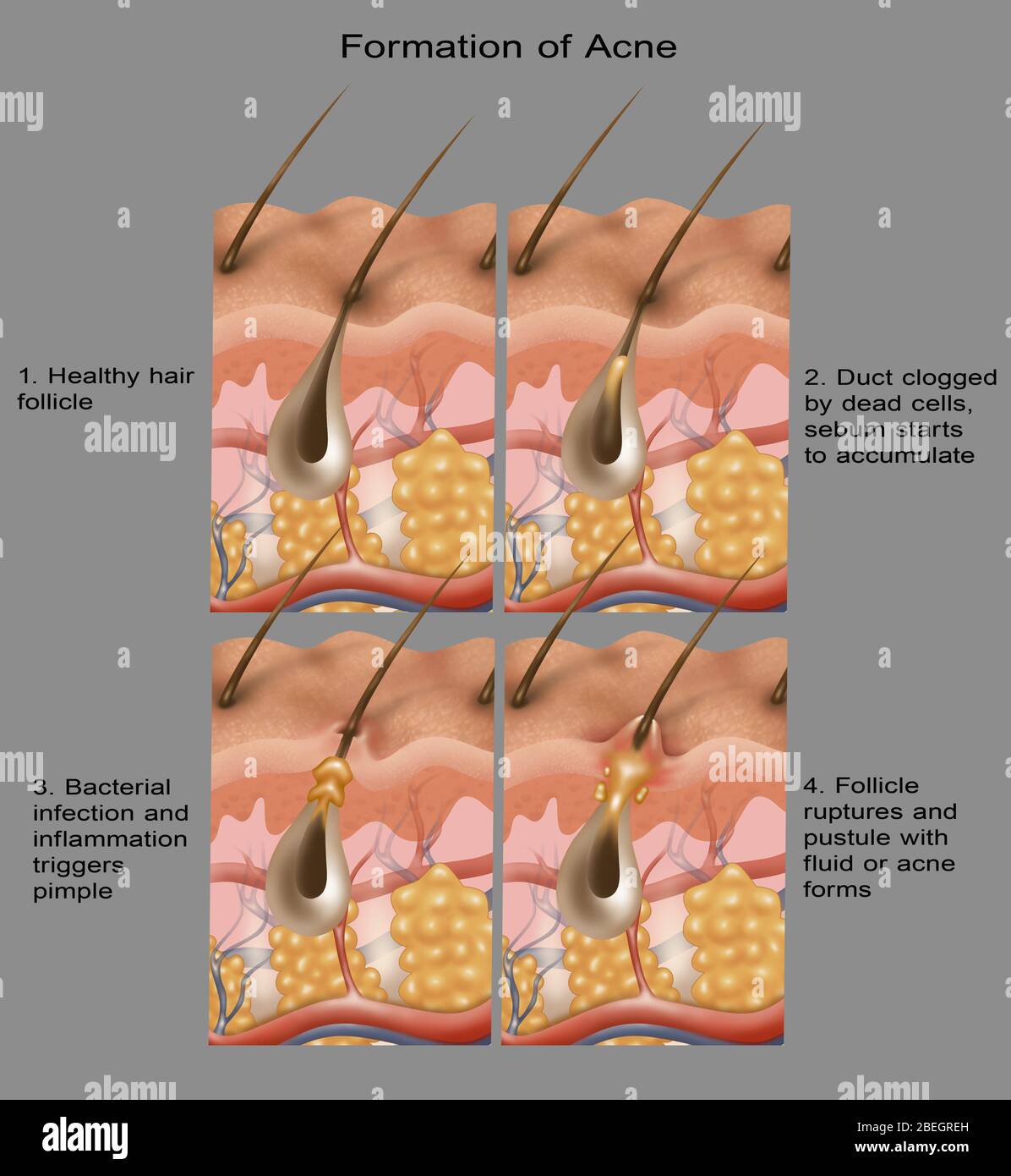 Hair follicles cross section hires stock photography and images Alamy