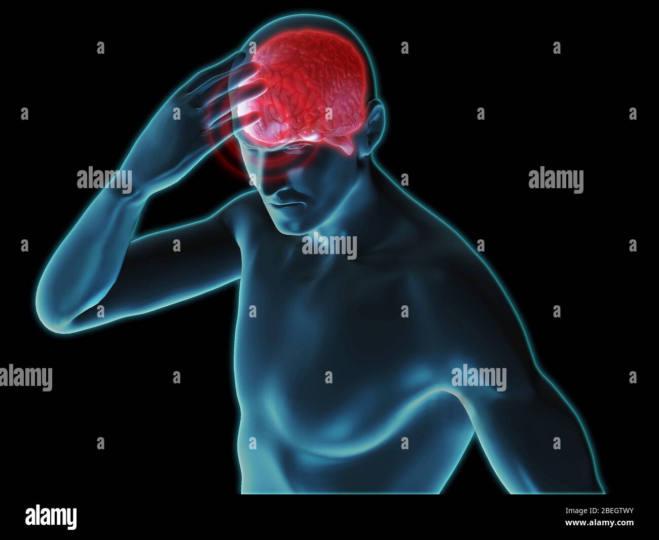 Headache Stock Photo