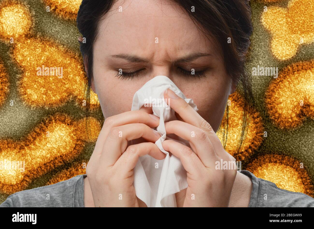 Последствия простуды. Больной ОРВИ. Грипп. Простуда и грипп. Легкий грипп.