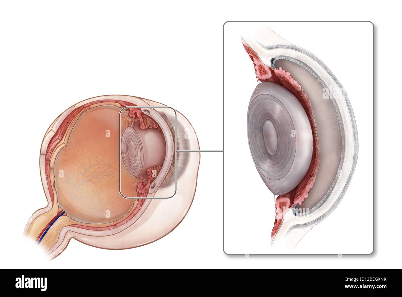 Anterior and Posterior Chambers of the Eye Stock Photo
