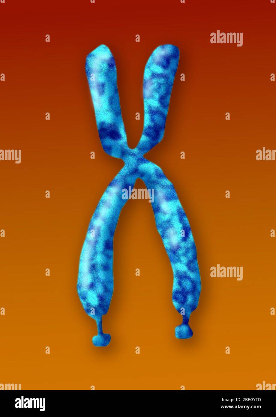 Fragile X Syndrome Stock Photo Alamy