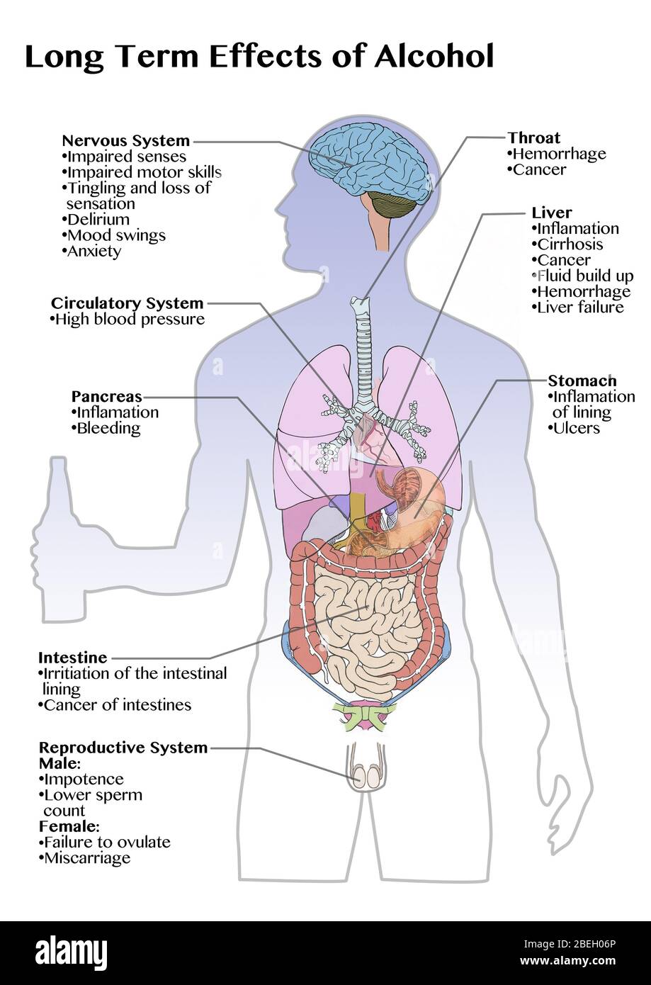 Long Term Effects of Alcohol Stock Photo