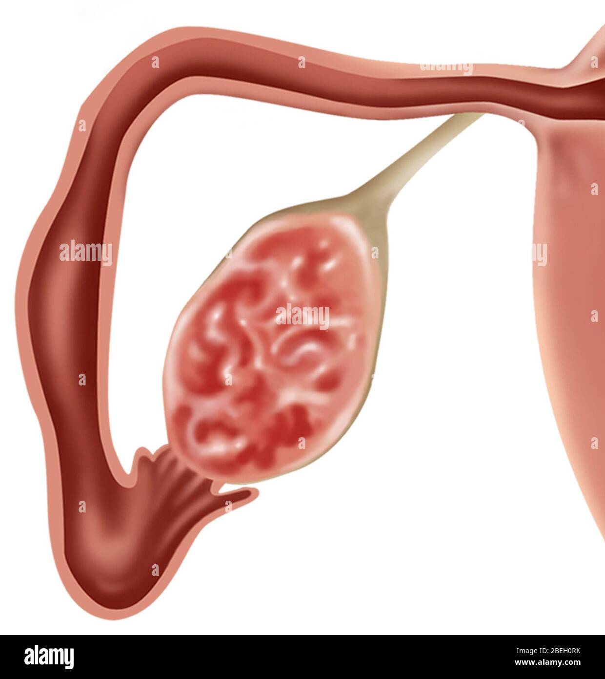 Fallopian tube section hires stock photography and images Alamy