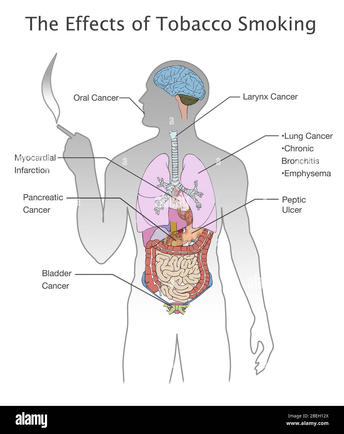 Side effects of smoking hires stock photography and images Alamy