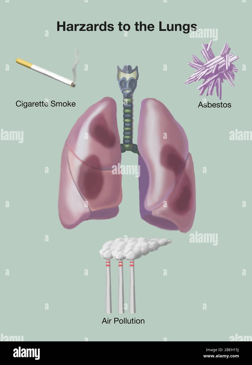 Hazards to the Lungs Stock Photo