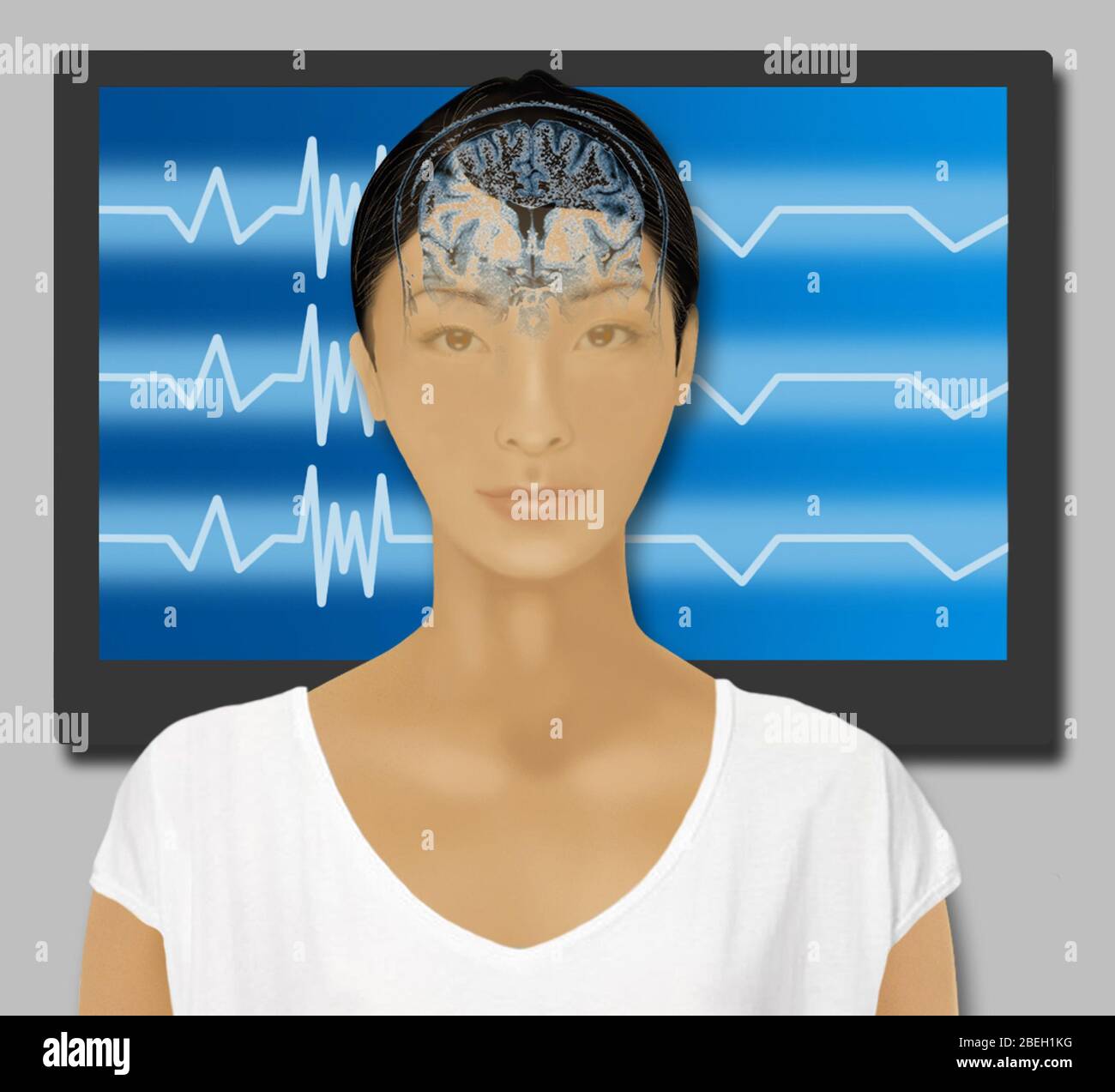 Biofeedback Therapy Stock Photo Alamy