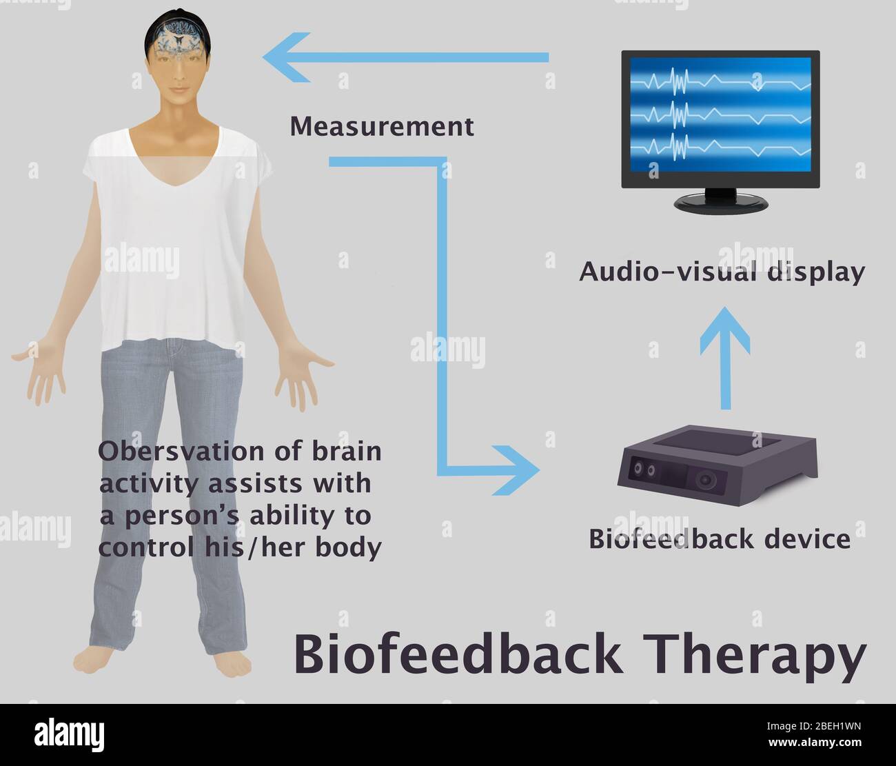 An illustration diagram of the feedback loop between person, sensor (biofeedback device), and processor (audio-visual display) to help provide biofeedback training. Biofeedback is sometimes used to improve health, performance, and the physiological changes that often occur in conjunction with changes to thoughts, emotions, and behavior. Observation of the brains reactions to different situations assists patients with controlling these reactions. Stock Photo