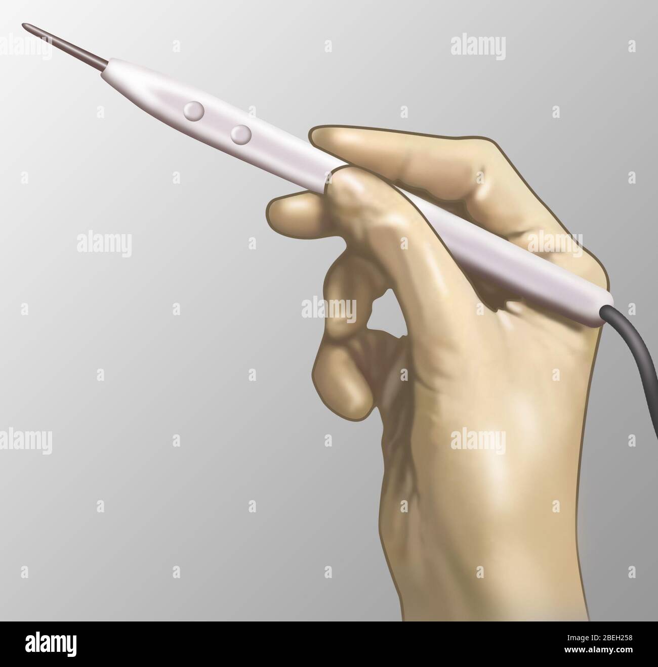 Cautery Knife Stock Photo Alamy