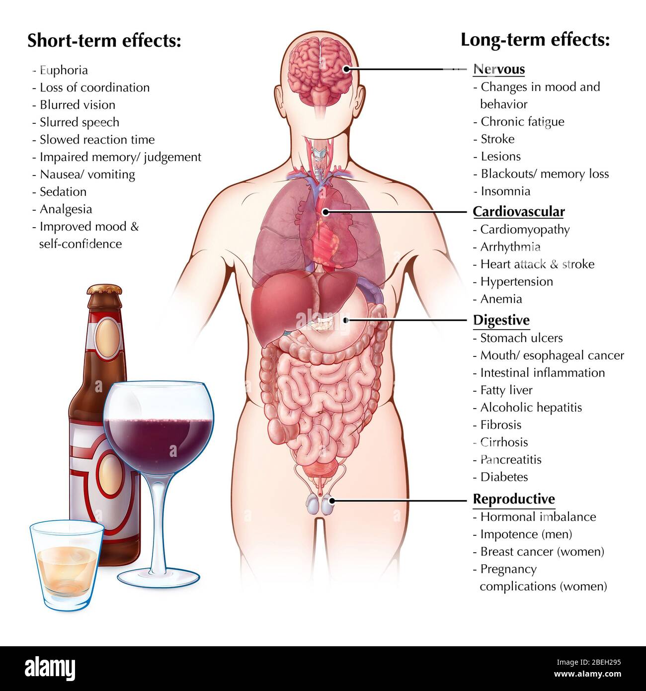 Effects of Alcohol Consumption Stock Photo