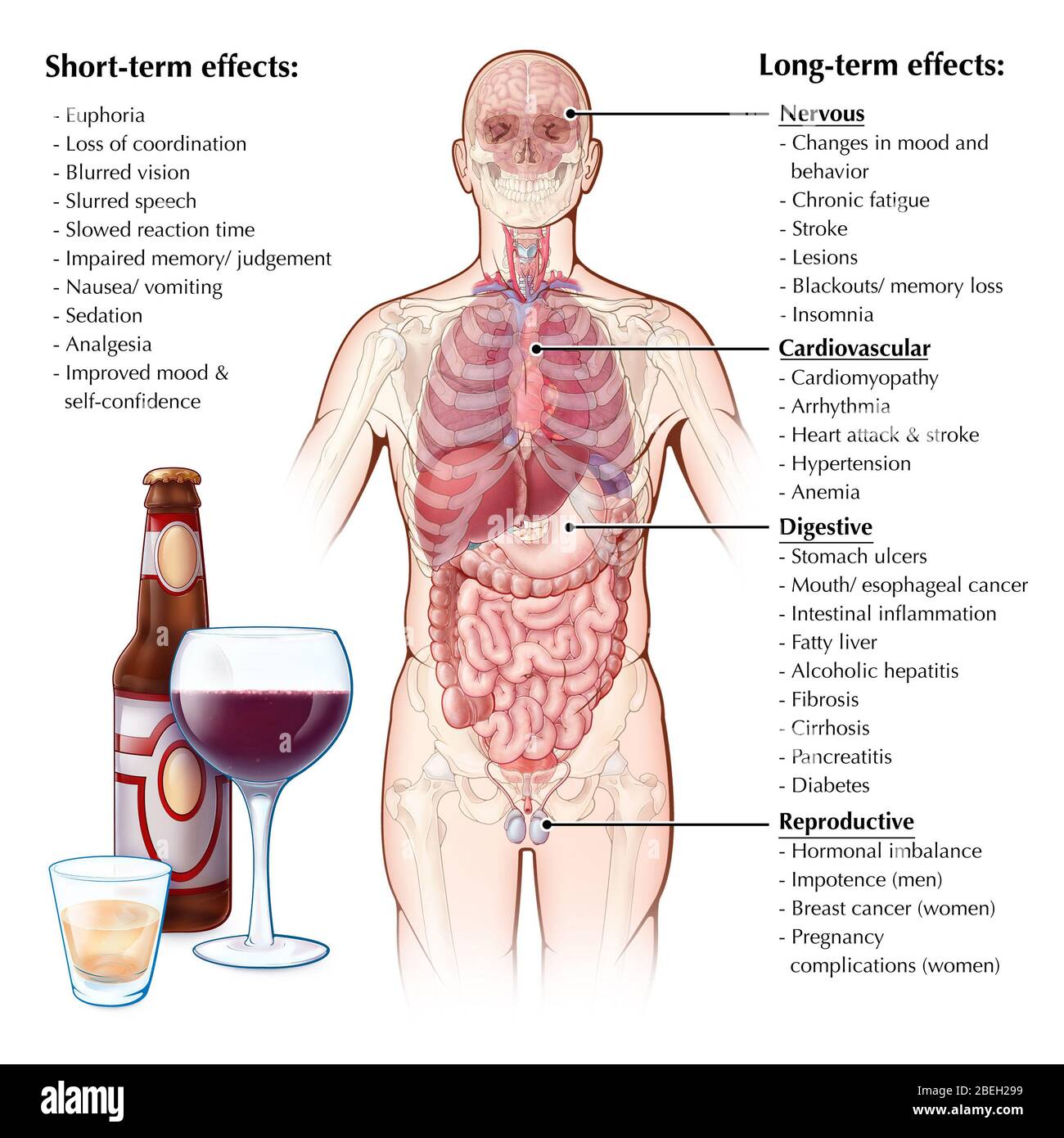 Effects of Alcohol Consumption Stock Photo