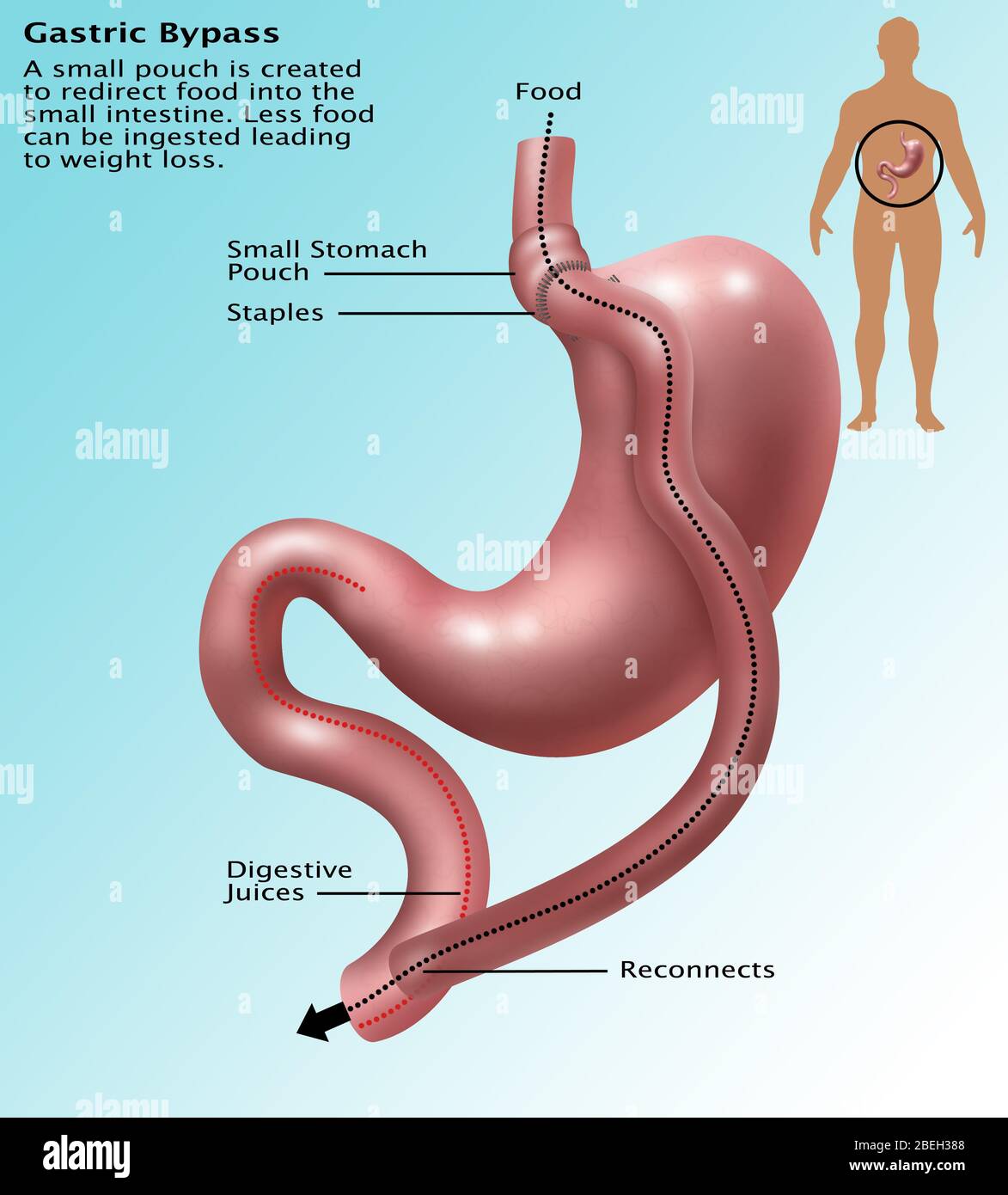 Gastric system diagram hires stock photography