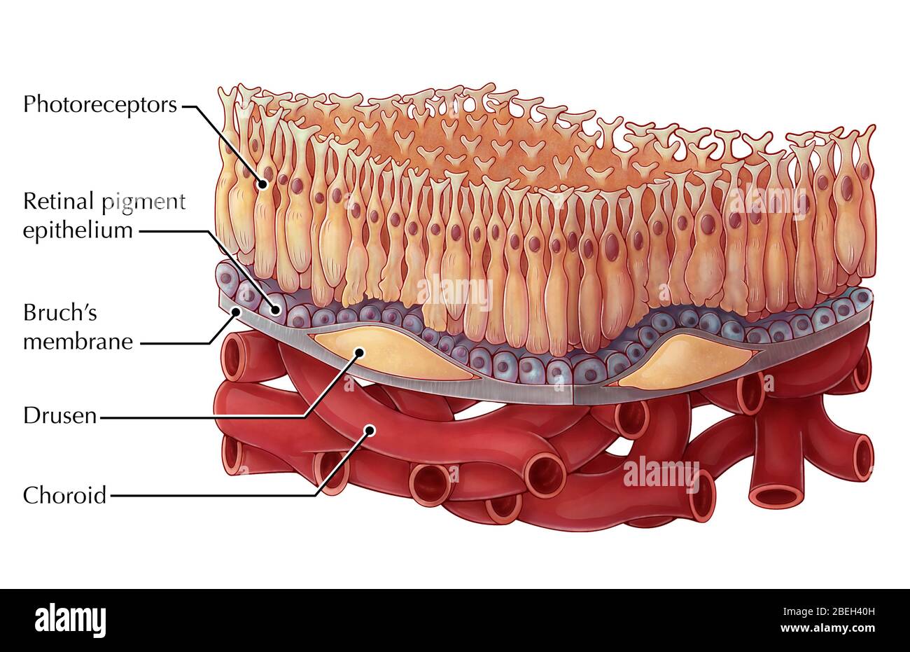 Dry AMD, Illustration Stock Photo