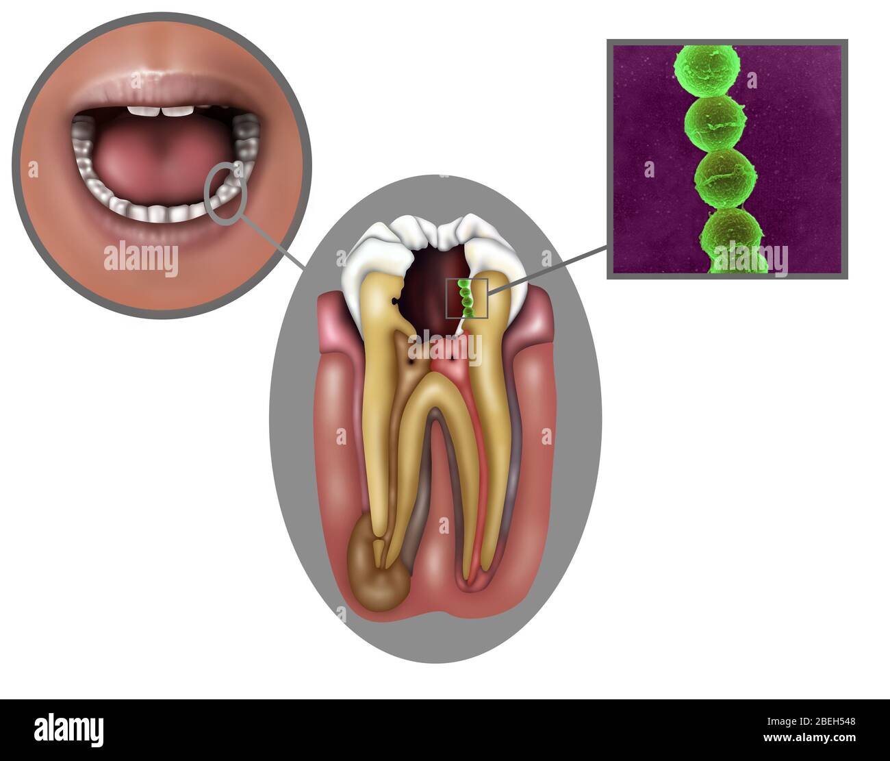 types of oral diseases